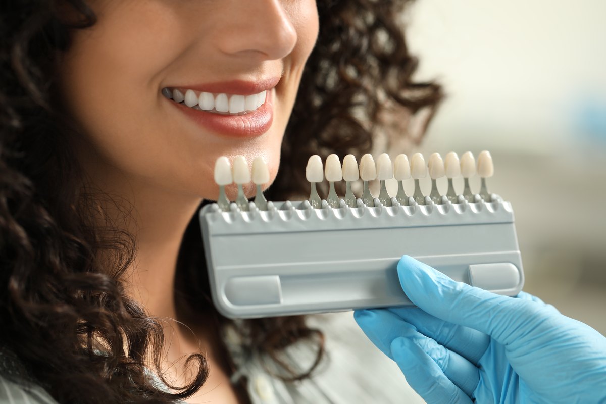 Blanqueamiento dental en España