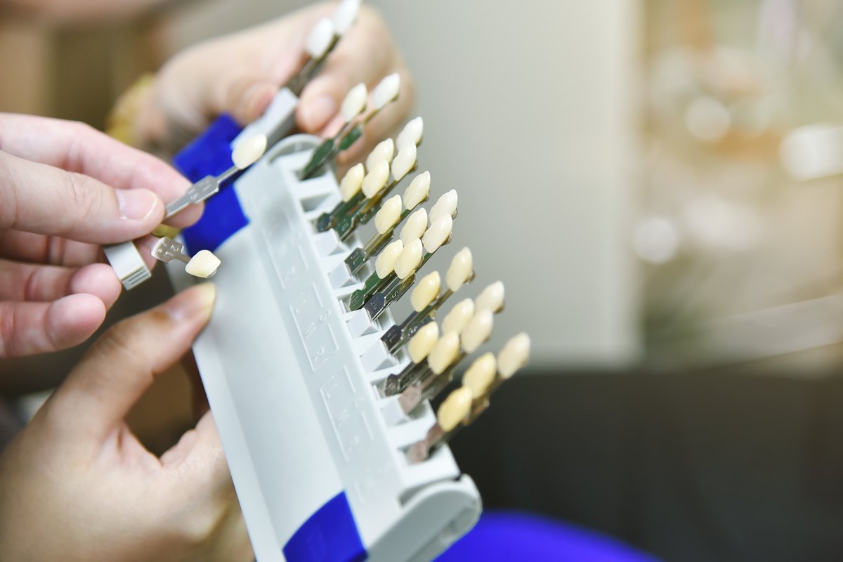 Guía de colores dental con muestras de dientes en abanico, sostenida por unas manos